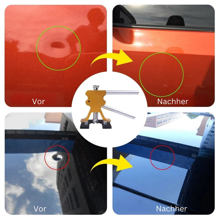DeukFix Repair Set – Car Dents Removal Without Paint Damage | Kalsten