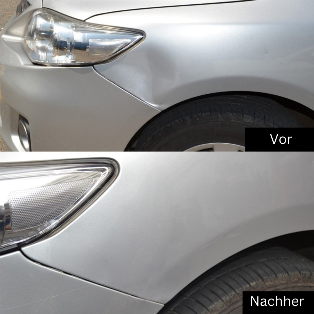 DeukFix Repair Set – Car Dents Removal Without Paint Damage | Kalsten