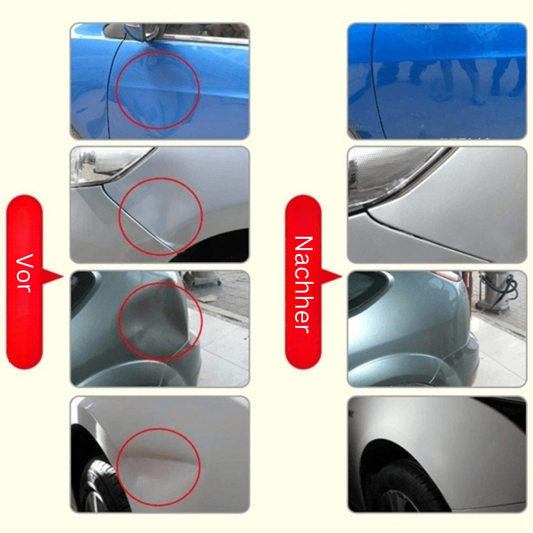 DeukFix Repair Set – Car Dents Removal Without Paint Damage | Kalsten