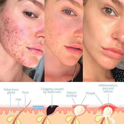 Skanto | Elysium Glow™ | Professional High-Frequency Facial Wand | Anti-Aging Skin Rejuvenation Device for Home Use and Spa Treatments