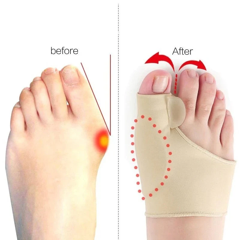 Kalsten | Toe Separator with Alignment Support