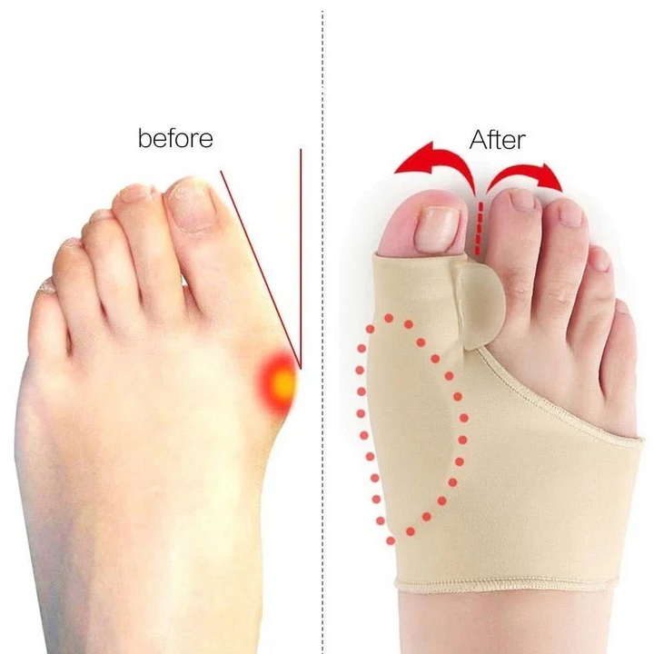 Kalsten | Toe Separator with Alignment Support