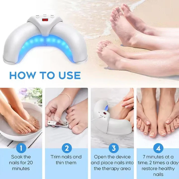 Kalsten | Nail Fungus Laser