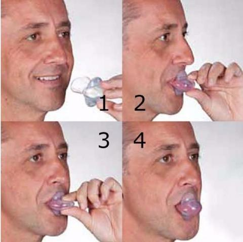 Kalsten | Apnea Tongue Stabilizing Device