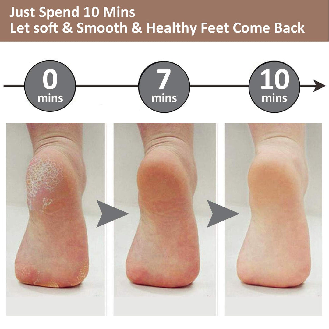 Kalsten | Electric Foot Pedicure Machine
