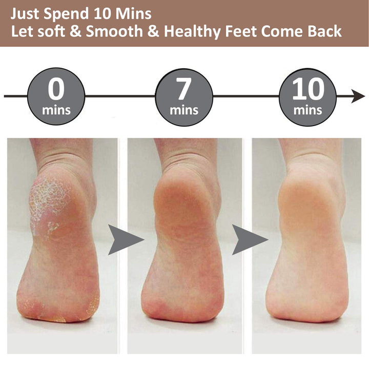 Kalsten | Electric Foot Pedicure Machine
