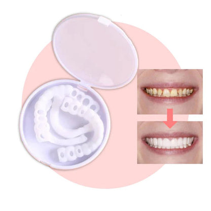 Skanto | SmileSnap - Always the perfect smile with these veneers