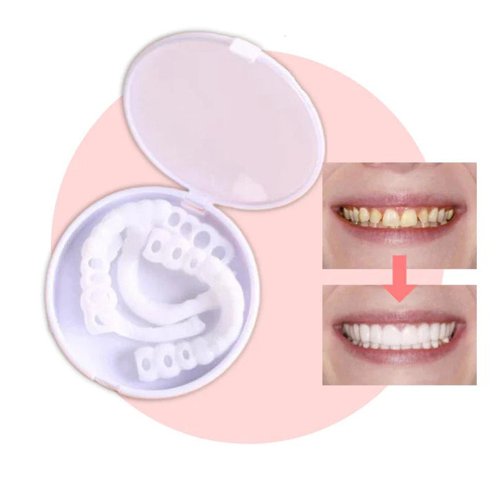 Kalsten | Snap-on Teeth™ - With these veneers, always have the perfect smile