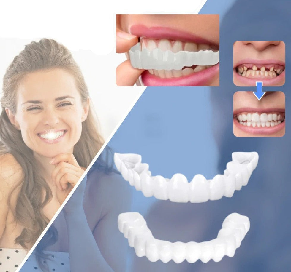 Kalsten | Snap-on Teeth™ - With these veneers, always have the perfect smile