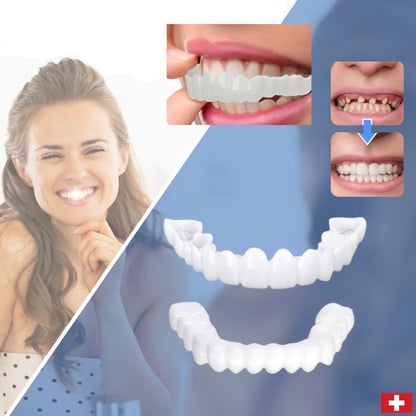 Skanto | SmileSnap - Always the perfect smile with these veneers