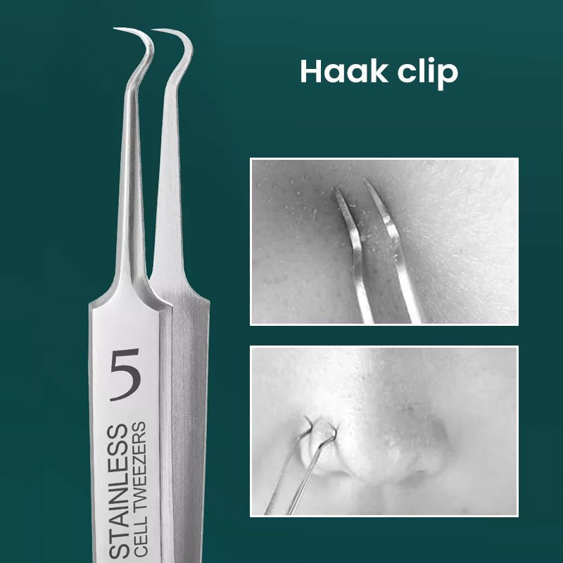 Kalsten | TweezeClear Targeted Blemish Extraction