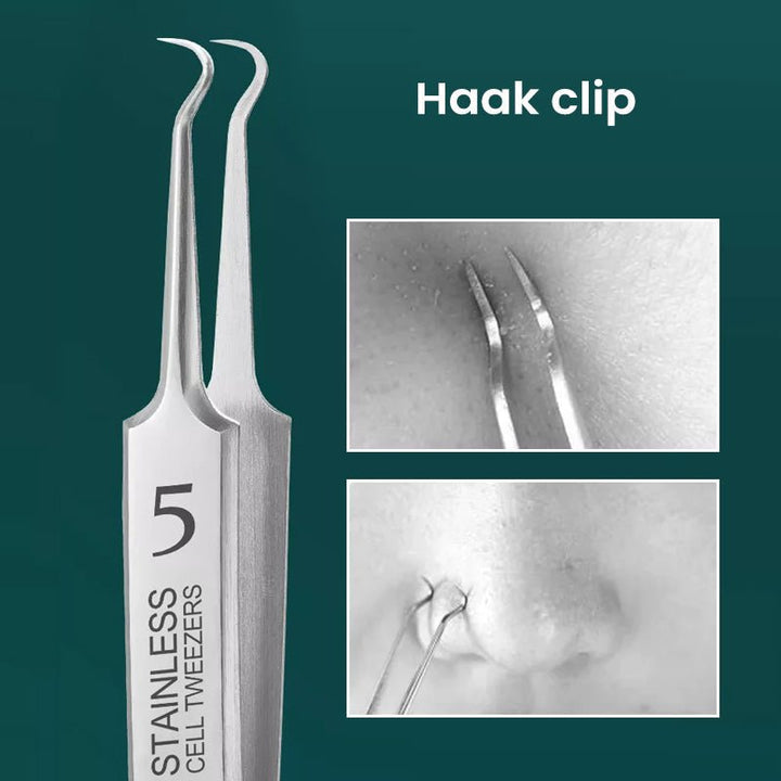 Kalsten | TweezeClear Targeted Blemish Extraction