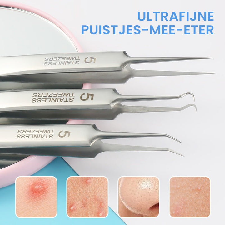 Kalsten | TweezeClear Targeted Blemish Extraction