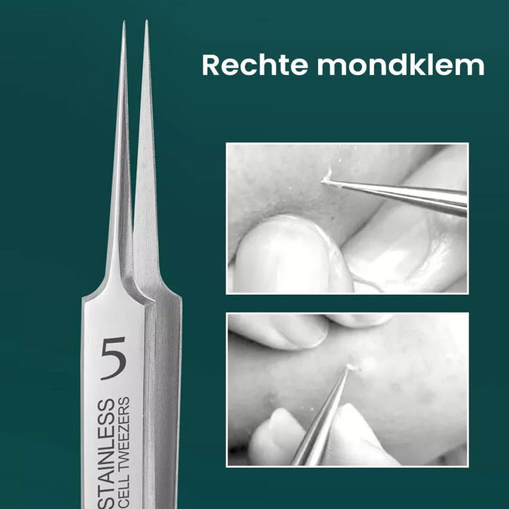 Kalsten | TweezeClear Targeted Blemish Extraction