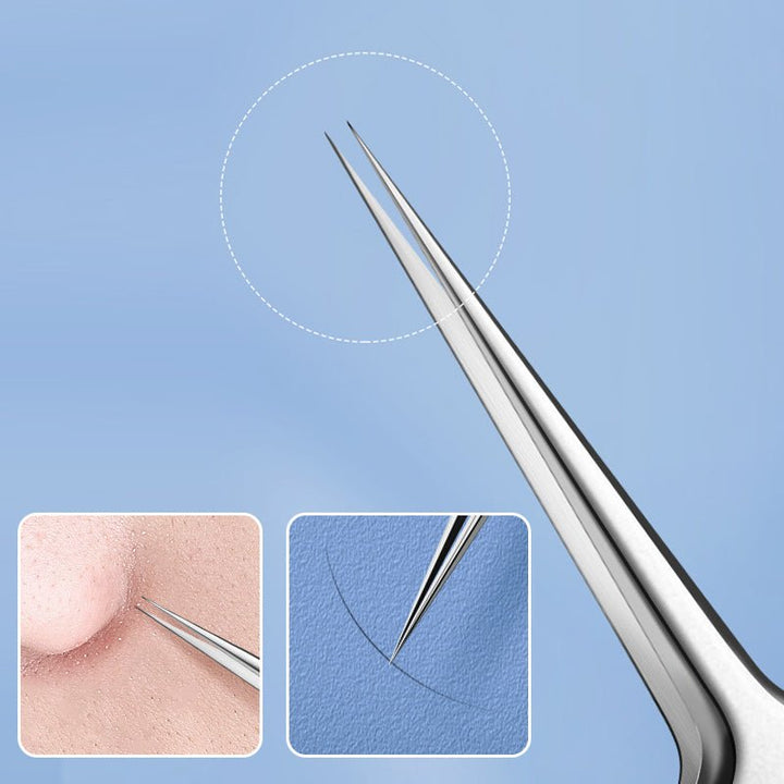 Kalsten | TweezeClear Targeted Blemish Extraction
