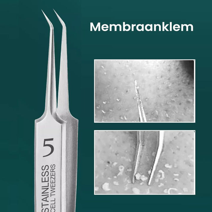 Kalsten | TweezeClear Targeted Blemish Extraction
