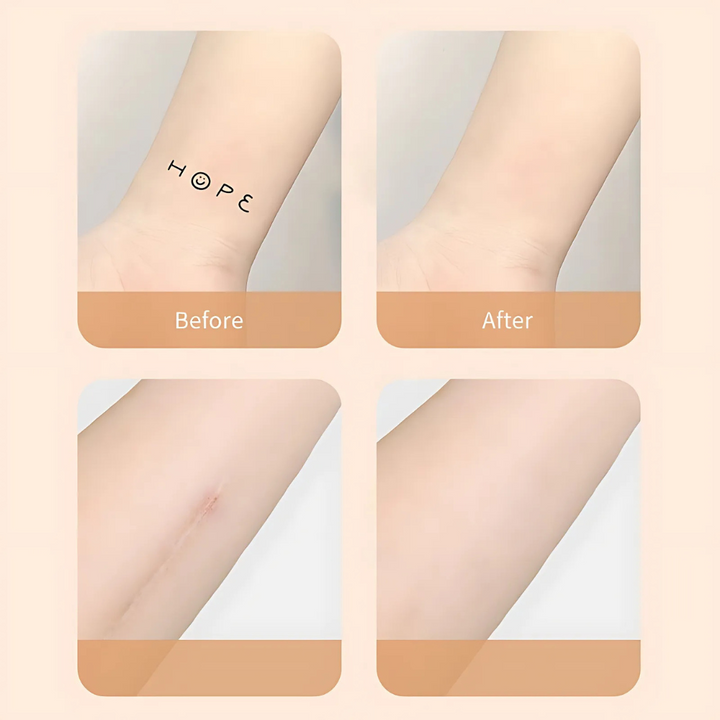 Kalsten | Scar Concealer Patch Waterproof Skin Cover