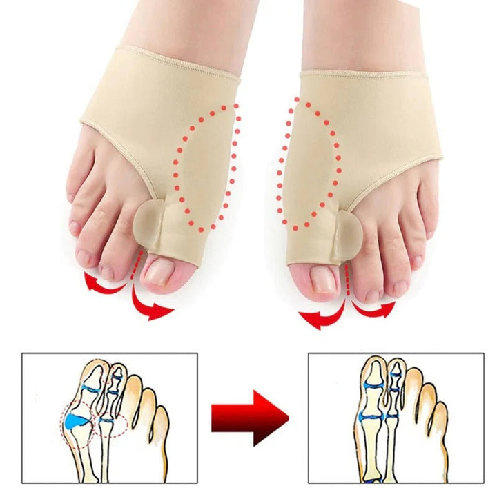 Kalsten | Toe Separator with Alignment Support