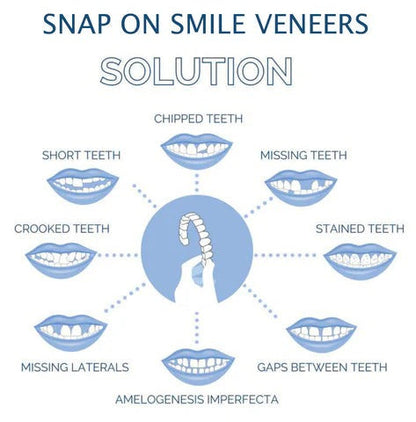 Skanto | Removable Smile Veneers for Upper and Lower Teeth