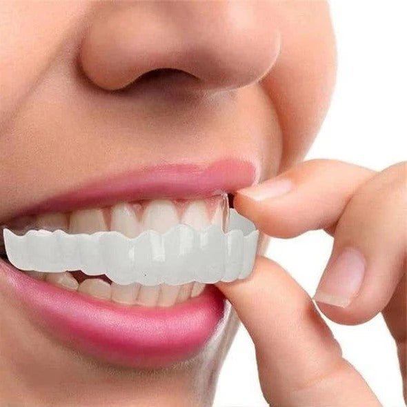 Kalsten | Removable Smile Veneers for Upper and Lower Teeth