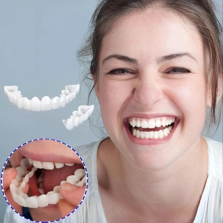 Kalsten | Removable Smile Veneers for Upper and Lower Teeth