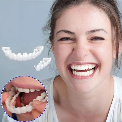 Removable veneers for upper and lower teeth