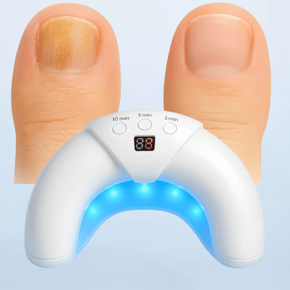Skanto | NailCare Light – Gentle LED Nail Care Device for Fingernails & Toenails