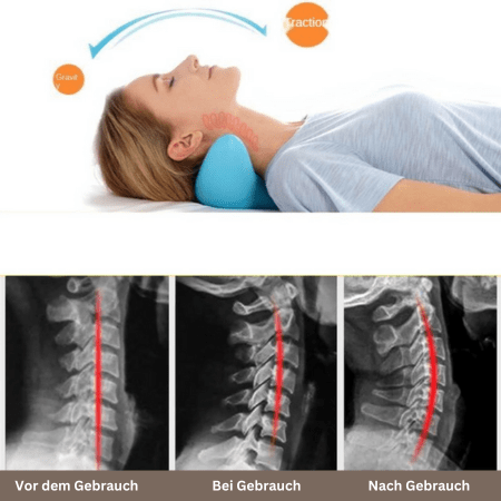 Skanto | Nekra – Ergonomic Neck Massage Pillow for Comfort and Relaxation