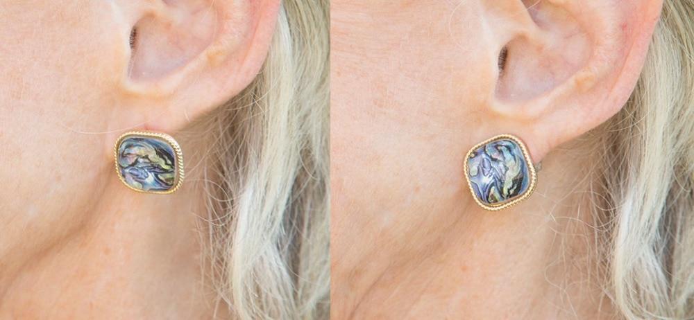 Earring Lift Back Clasp Support | Kalsten