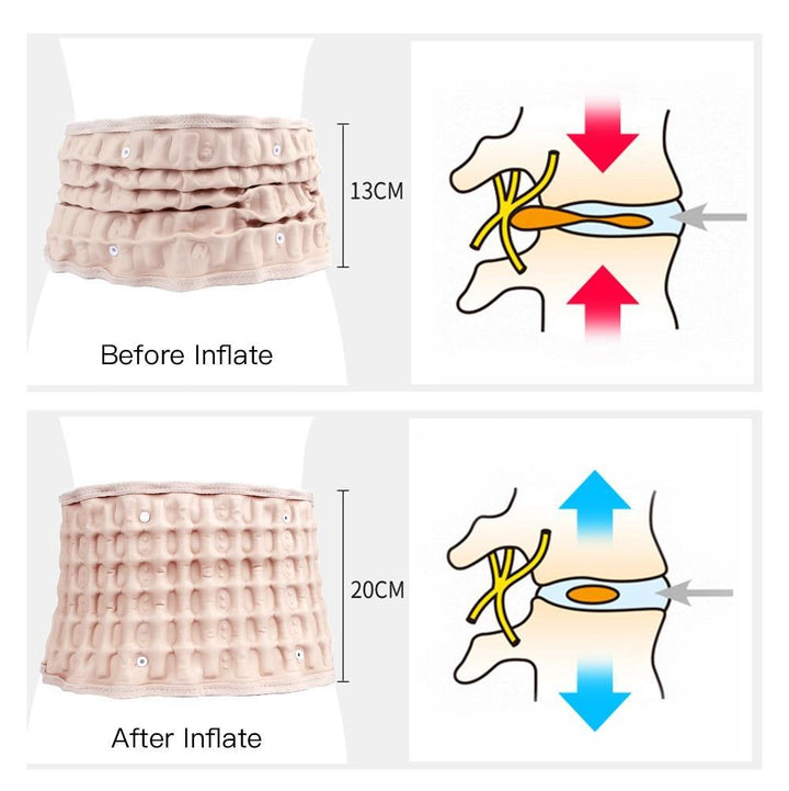 Lumbar Decompression Belt | Kalsten
