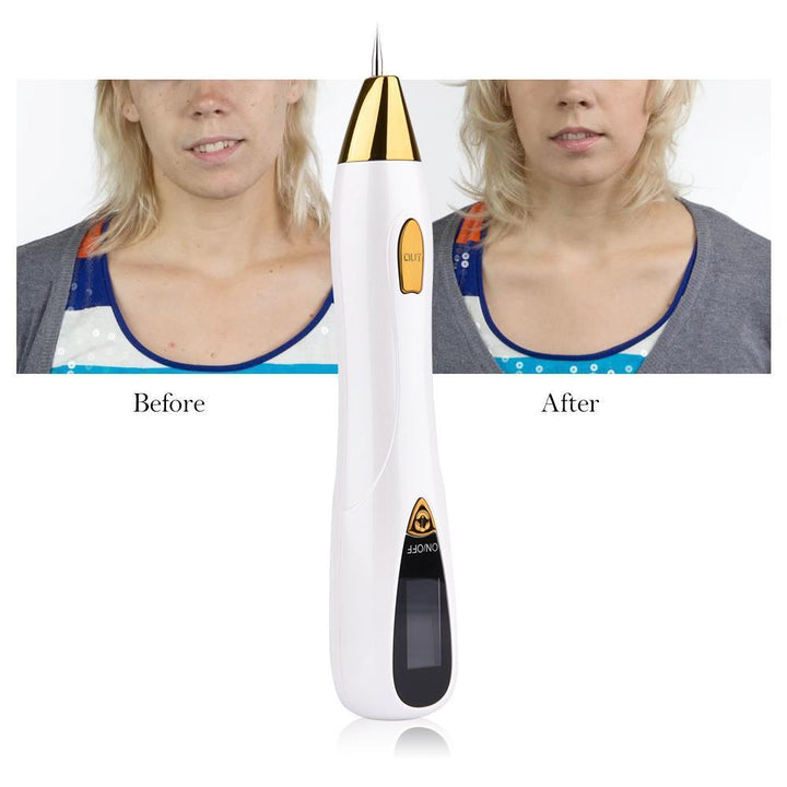 Kalsten | Deluxe Skin Tag and Mole Remover and Freckles, Blemishes, Warts