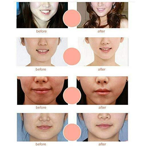 Kalsten | V Line Chin Up Face Lift Mask