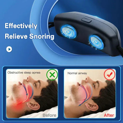 Sandsberg | Smart Anti-snoring Device EMS Pulse Stop Snoring Portable Comfortable Sleep Well Stop Snoring Healthcare Sleep Apnea Aid USB