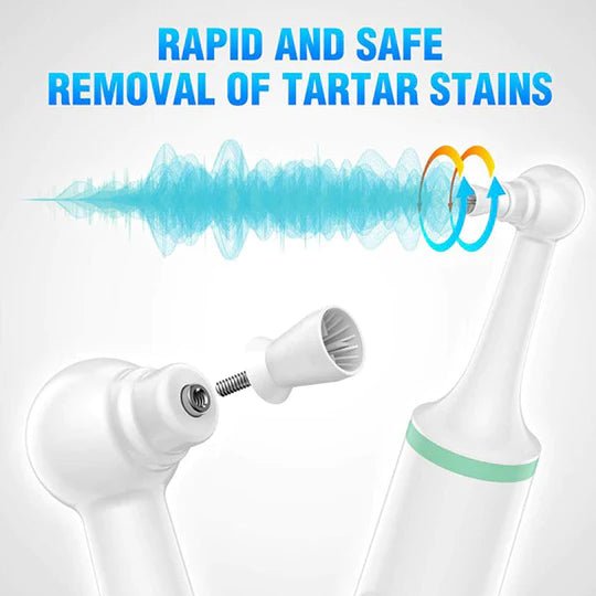 Skanto | SMILEPRO – Sonic Tooth Cleaner with Ultrasound Technology for Deep Oral Hygiene
