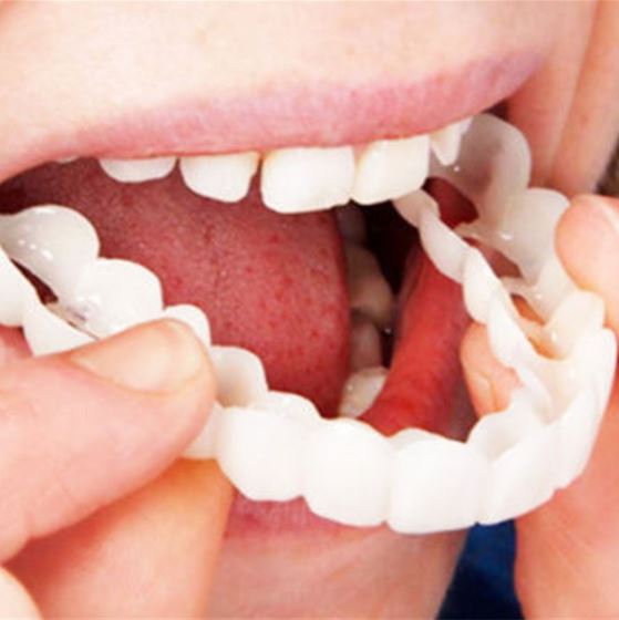 Kalsten | Snap-on Teeth™ - With these veneers, always have the perfect smile