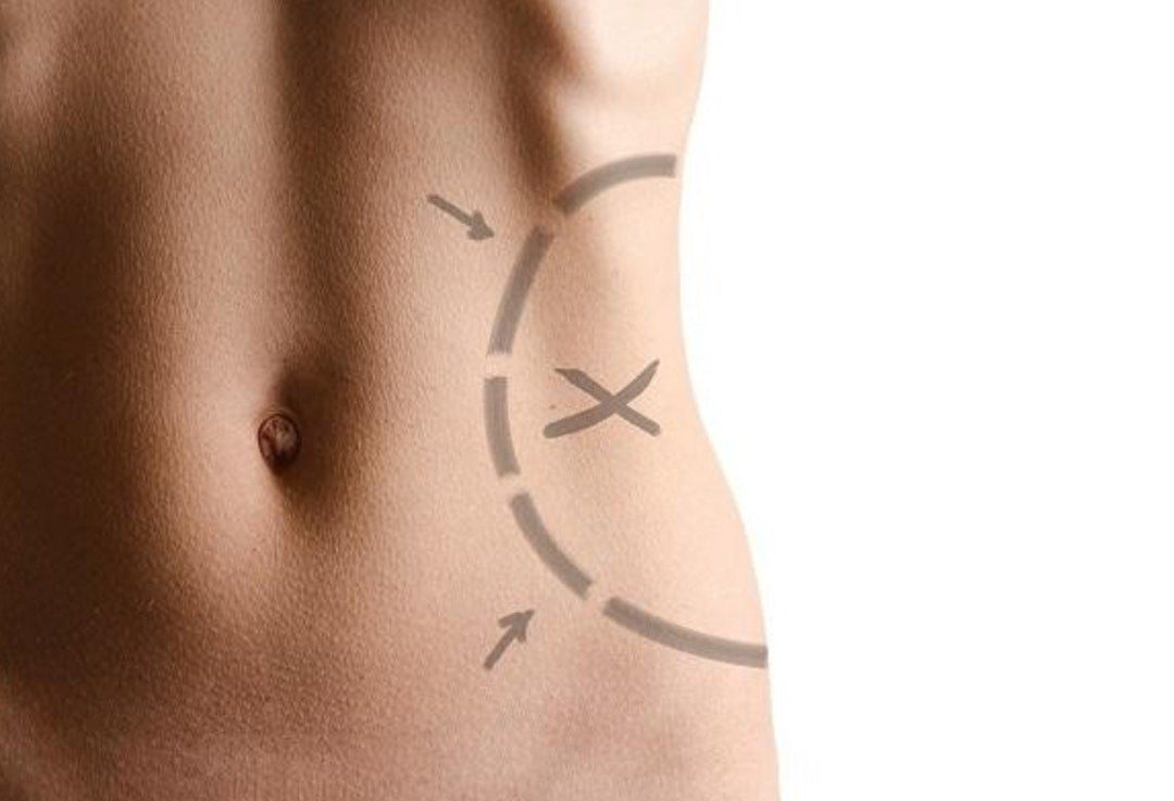 Ultrasound Slimming Device for Home Use | Kalsten